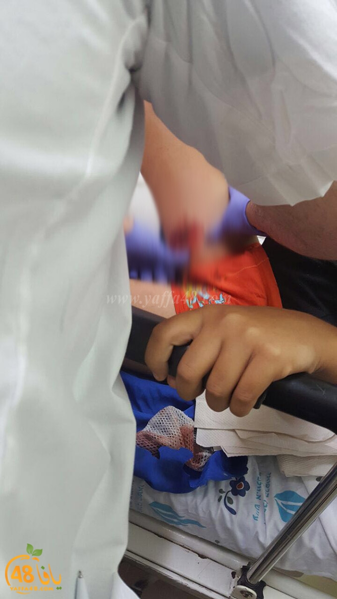 kid dog attack (4).jpg